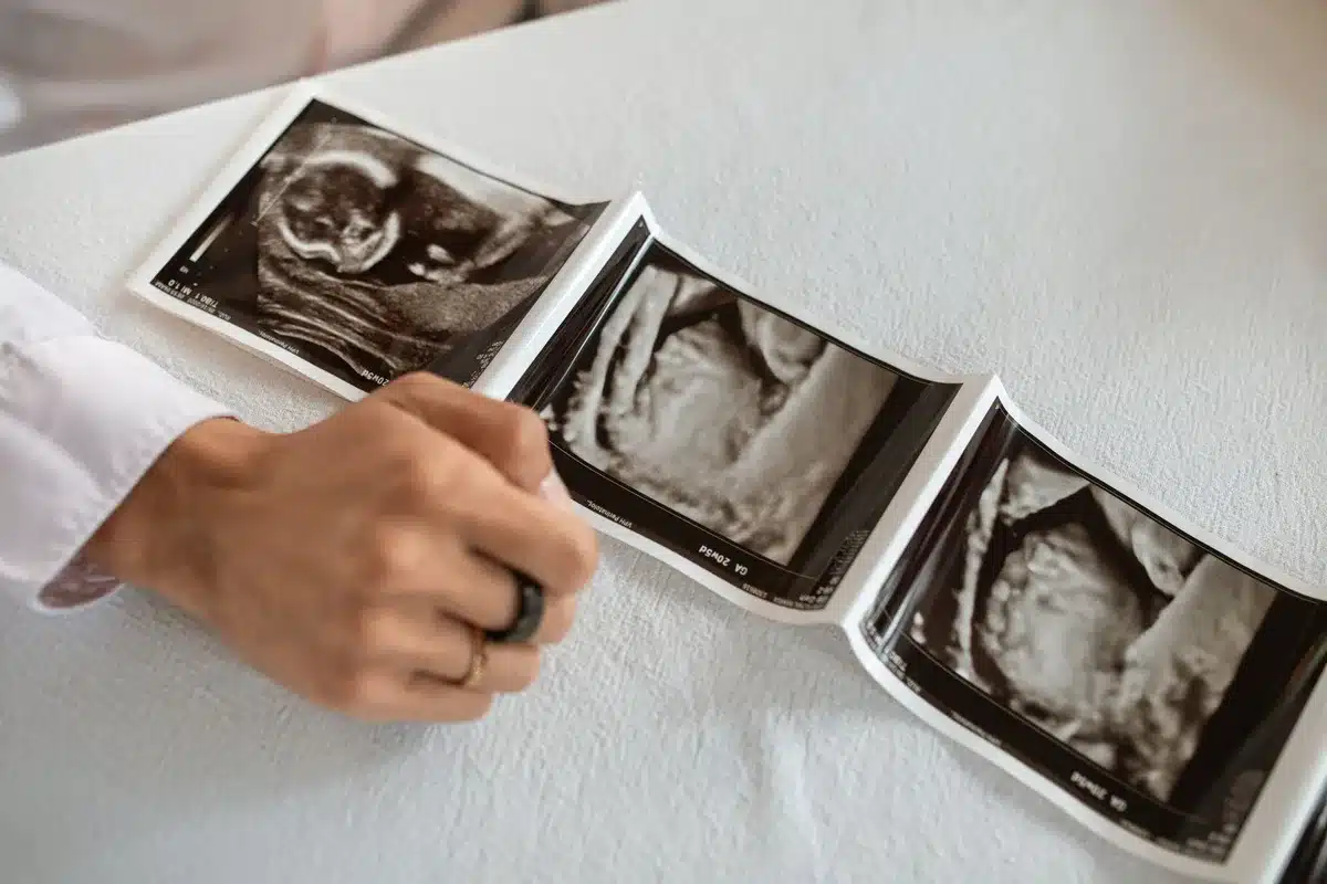 A smartphone screen showing medical appointment details and fertility clinic information, surrounded by notes about reproductive health options and insurance coverage