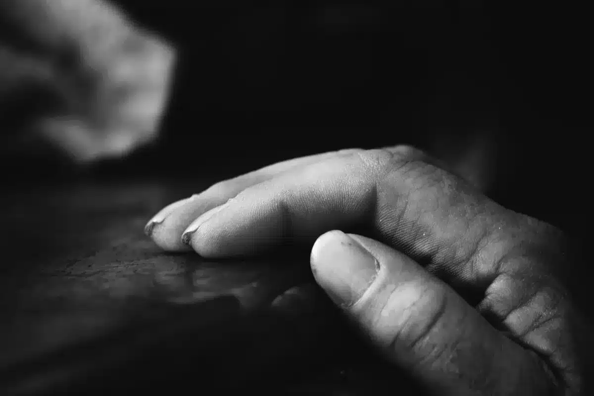A close-up of an elderly person's hands showing visible bruising and discoloration, resting on a table in natural daylight